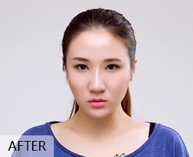 after